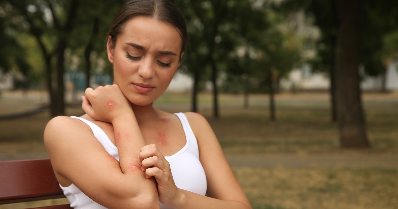 Nie tylko poparzenia. Pokrzywka słoneczna i trądzik Mallorca to mniej znane letnie problemy skórne