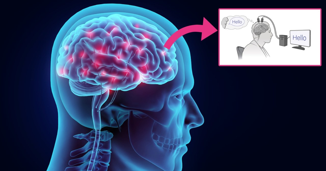 Czytanie w myślach jest możliwe? Powstał niezwykły implant mózgowy