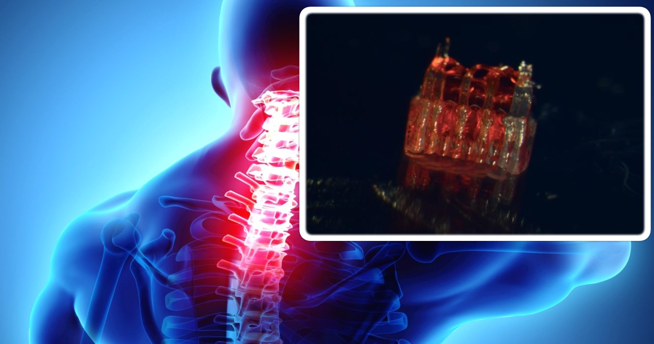 Rdzeń kręgowy z druku 3D. Szansa dla sparaliżowanych pacjentów
