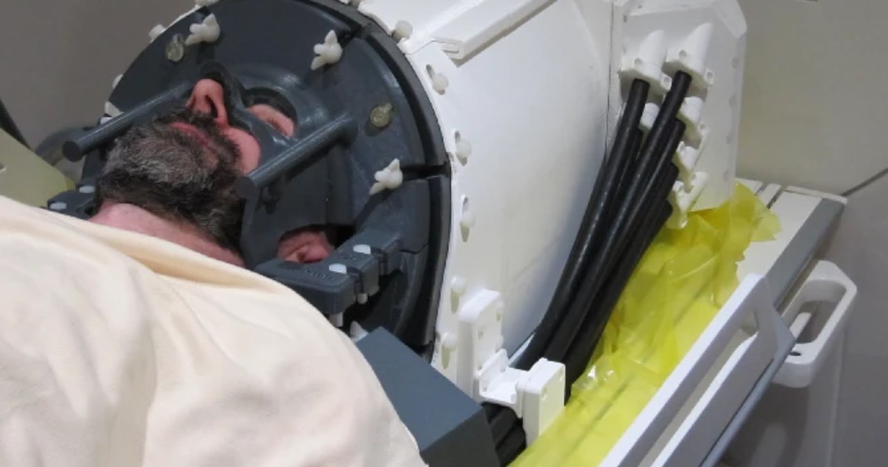 Ultradźwiękowy kask zamiast operacji. Przełom w leczeniu chorób mózgu