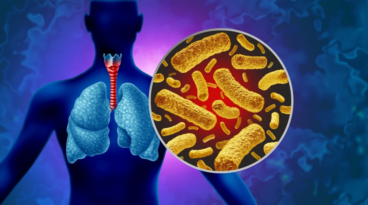 Hiszpania zmaga się z największą od pół wieku falą zachorowań na krztuśca. W ciągu kilku miesięcy odnotowano niemal 29 tysięcy przypadków tej groźnej choroby. W Polsce sytuacja też nie wygląda najlepiej. W ubiegłym roku odnotowano ponad 32 tysiące przypadków krztuśca - niemal 35 razy więcej niż rok wcześniej. Eksperci biją na alarm i apelują o szczepienia.