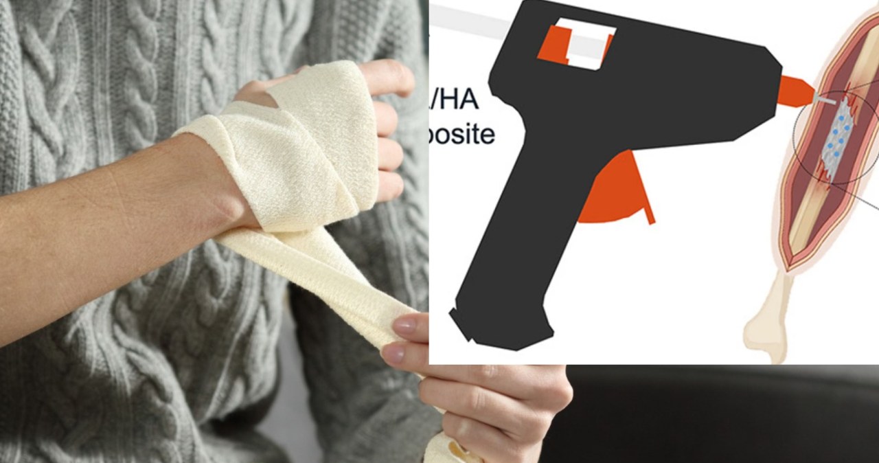 Drukarka do kości drukuje implanty dokładnie tam, gdzie są potrzebne