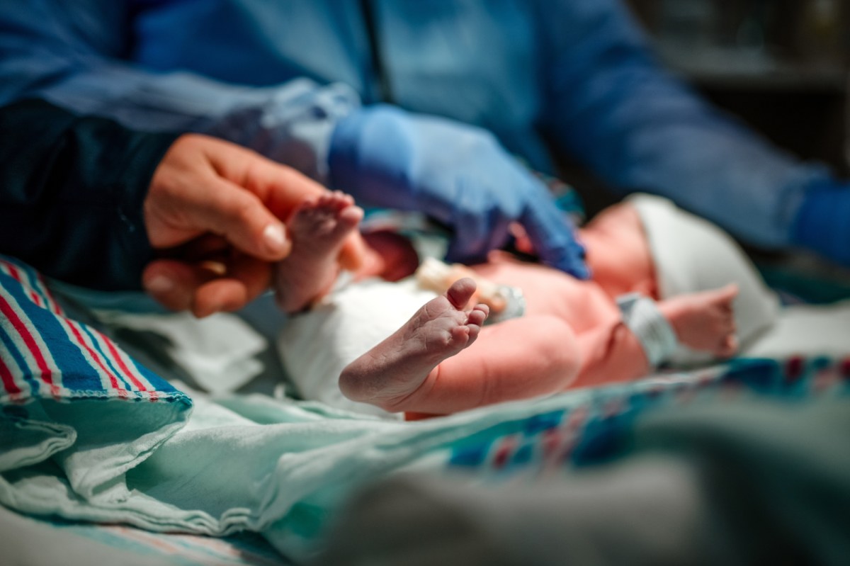 Operacja w 11. minucie życia. Noworodek z guzem wielkości serca