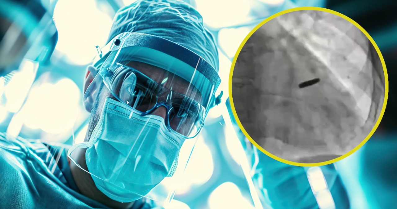 Spędził trzy lata z pociskiem w sercu. "Miał wielkie szczęście"