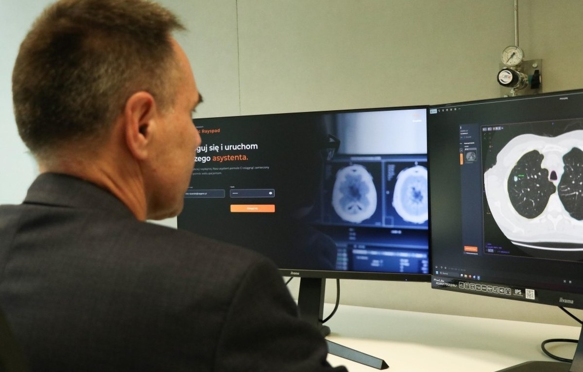 AI kontra choroby. Technologia z AGH zmienia diagnostykę