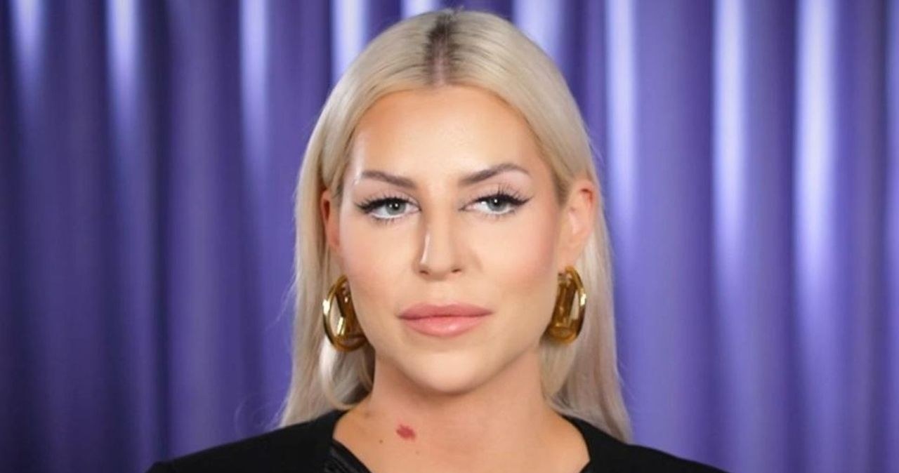 Julia von Stein już tak nie wygląda. Pokazała efekty kosztownych zabiegów