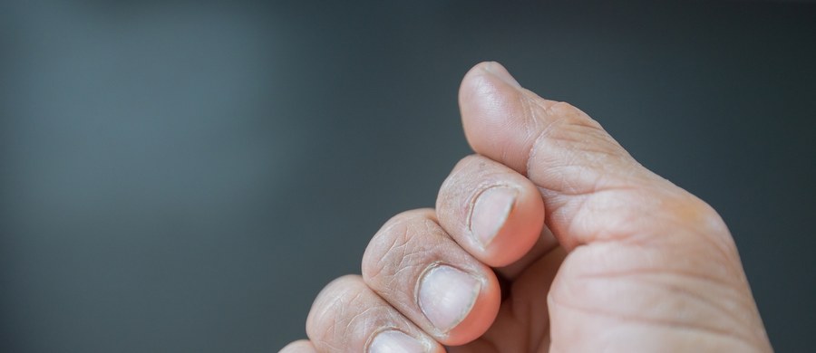 Paznokieć prawdę nam powie? Brzmi trochę, jak próba wróżenia, a płytka oczywiście nie może być traktowana, jak wyrocznia i podstawa do postawienia diagnozy. Warto jednak zwrócić uwagę na niektóre cechy i zmiany – które mogą być wskazówkami i świadczyć o problemie zdrowotnym.