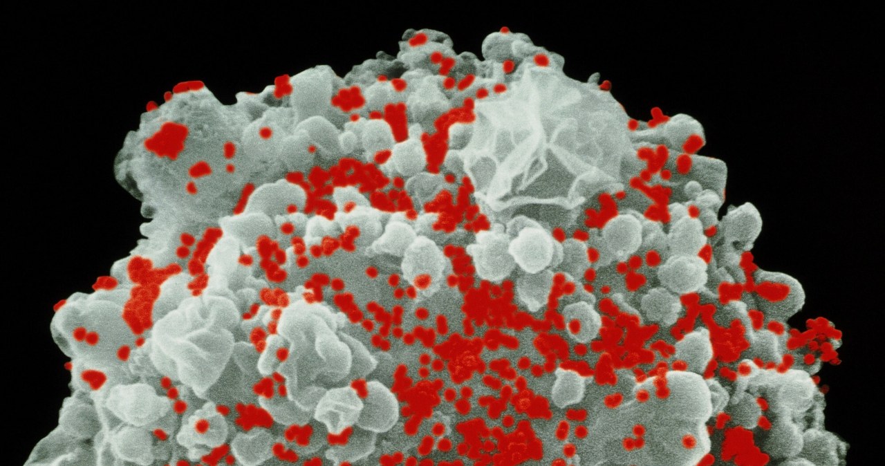 Nowe przeciwciało neutralizuje wirus HIV. Wyjątkowe odkrycie naukowców