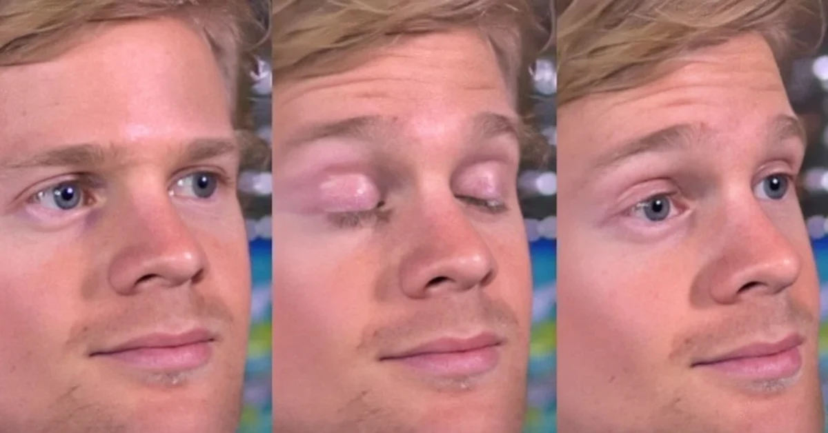 Twarz Drew Scanlona jest rozpoznawalna przez internautów na całym świecie. Mężczyzna zrobił jednak wiele, by kojarzyć się nie tylko z memami, ale także z działalnością charytatywną. Scanlon zebrał już ponad 300 tysięcy dolarów na badania nad stwardnieniem rozsianym.