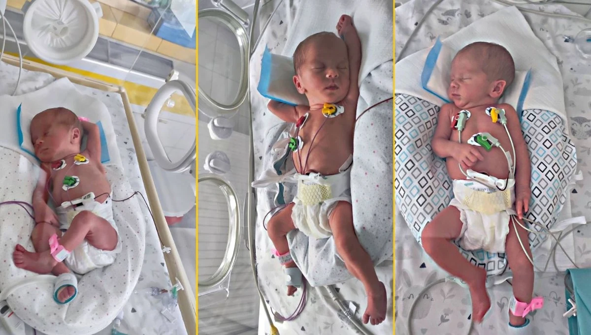 Pola, Julia i Zuzia - tak nazywają się trojaczki, które urodziły się w Szpitalu "Zdroje" w Szczecinie. Dziewczynki urodziły się w wyniku cesarskiego cięcia, w 31. tygodniu ciąży.