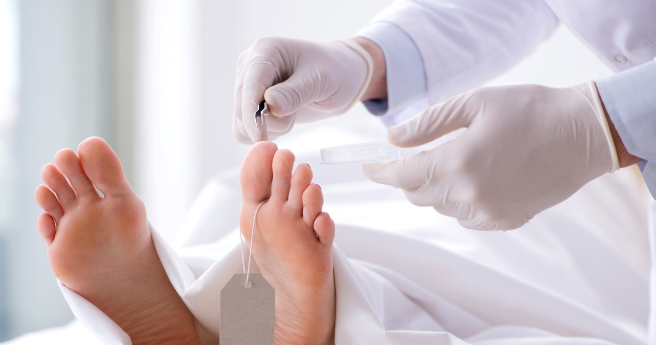 Śmierć poza szpitalem. Koroner będzie stwierdzał zgon w Polsce