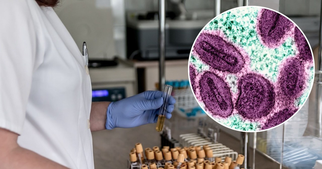 Nowe przypadki zakażeń w kilku krajach Europy. WHO ostrzega przed wirusem