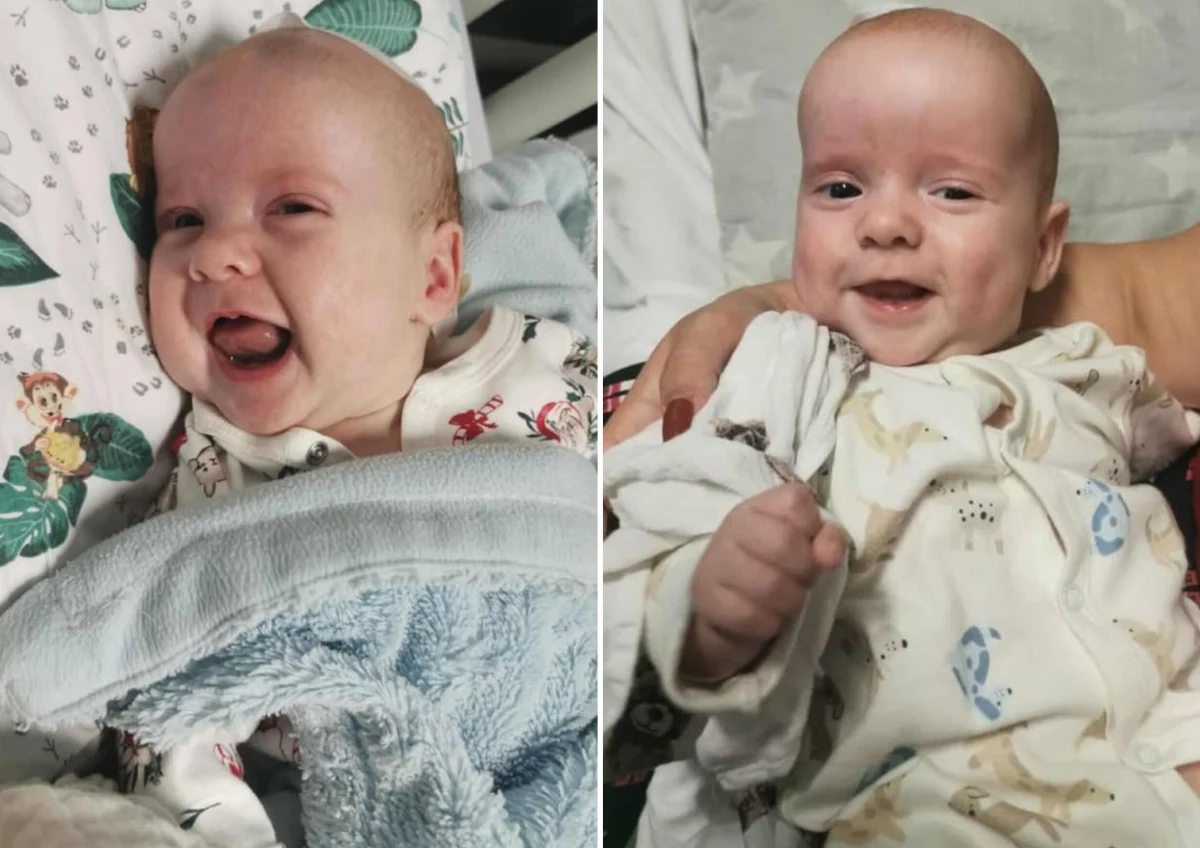 Górnośląskie Centrum Zdrowia Dziecka im. św. Jana Pawła II w Katowicach poinformowało o wyjątkowym wydarzeniu w swojej historii - w placówce przeprowadzono pierwszy jednoczesny zabieg neurochirurgiczny u bliźniąt Ignasia i Wiktorka, pacjentów z rozpoznaną kraniosynostozą.