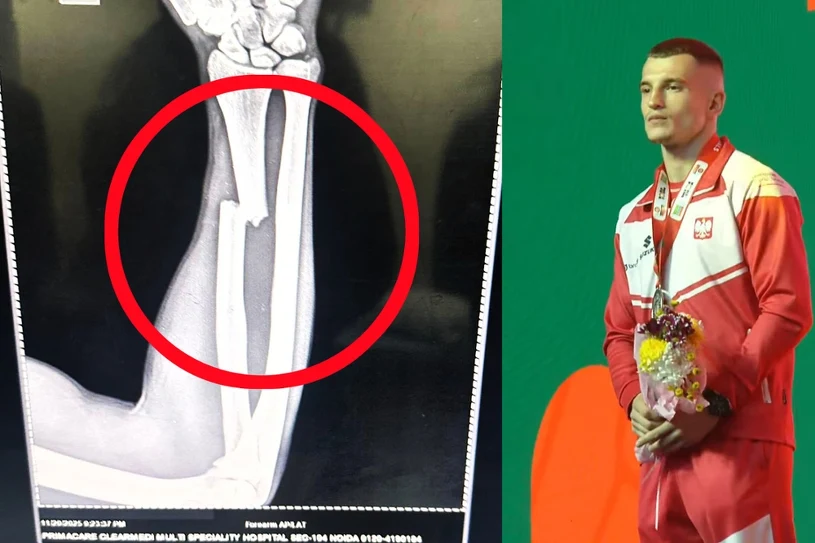 Dramat polskiego bohatera w finale w Indiach. Z podium prosto do szpitala