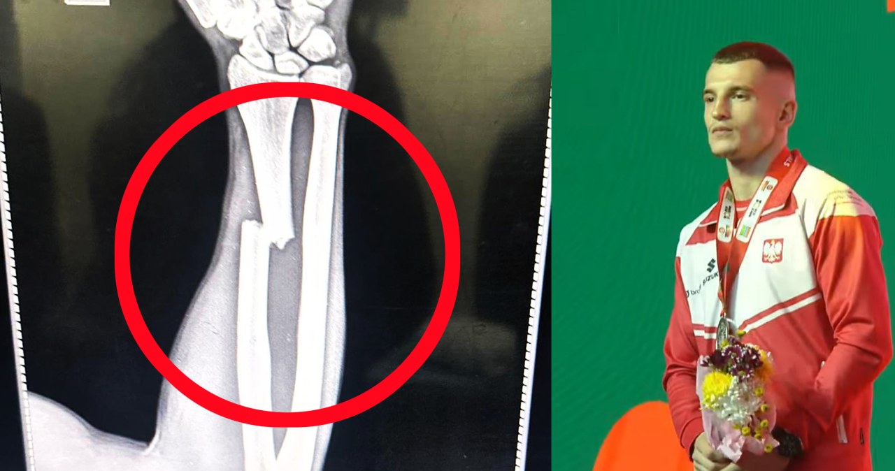 Dramat polskiego bohatera w finale w Indiach. Z podium prosto do szpitala