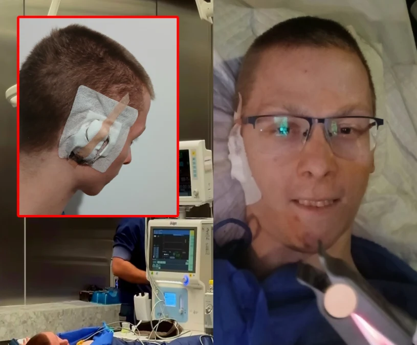Lekarze z Warszawy stworzyli mu nowe ucho. Niezwykła historia Kamila