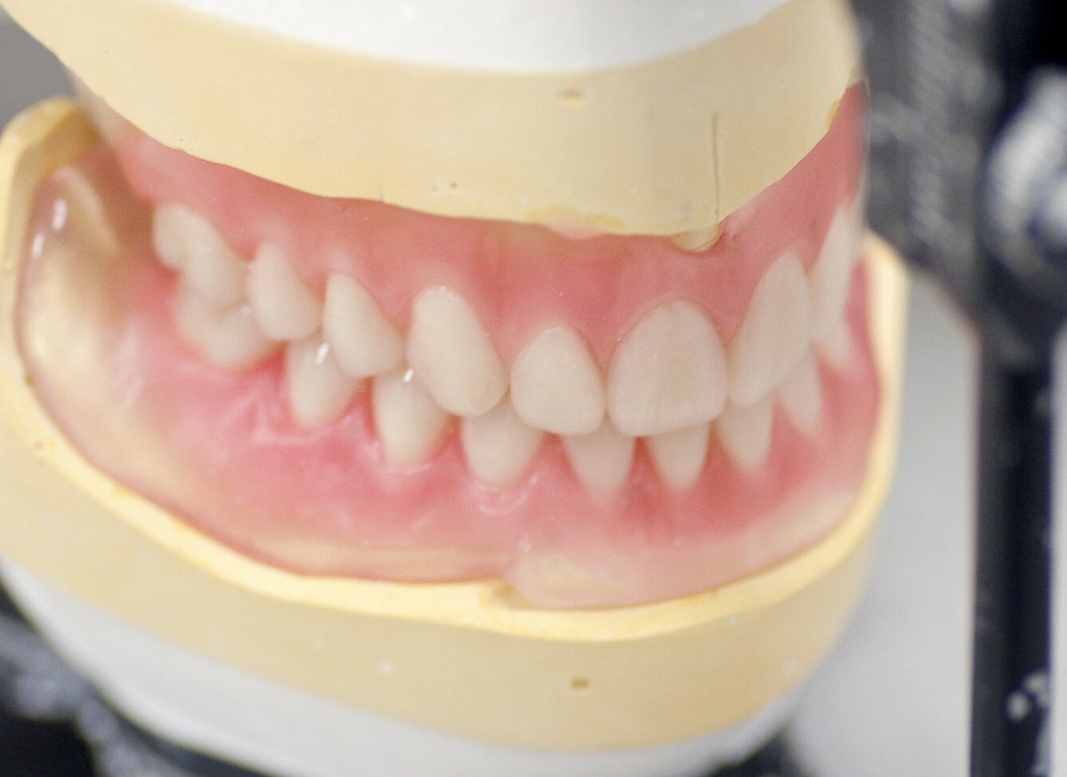 Kupił w sieci protezę zębową. Nie mógł uwierzyć w to, co zobaczył