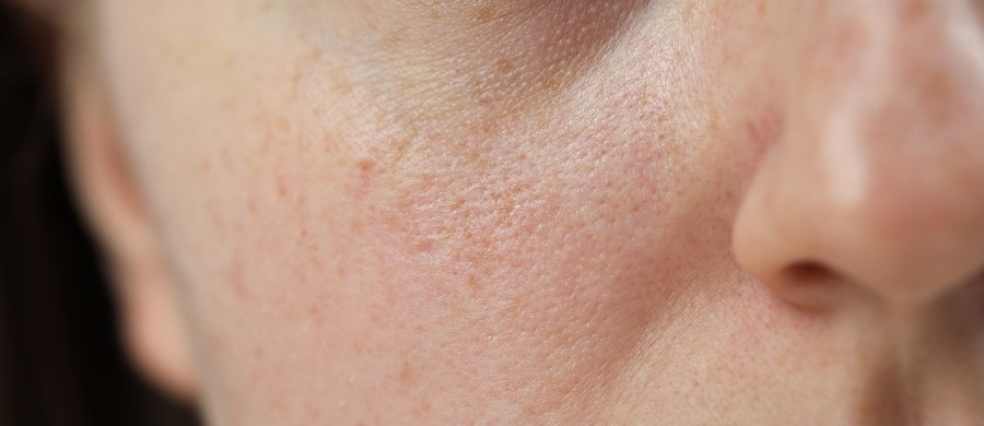 O tym, jak przygotować twarz i ciało do sezonu świąteczno-noworocznego mówimy w tym tygodniu w cyklu Twoje Zdrowie w Faktach RMF FM. Podpowiedzi przygotowali eksperci, wśród nich dermatolodzy i specjaliści medycyny estetycznej. W przyszłym tygodniu - według prognoz synoptyków - nadejdzie ochłodzenie, a w niektórych regionach w drugiej połowie tygodnia wróci mróz.