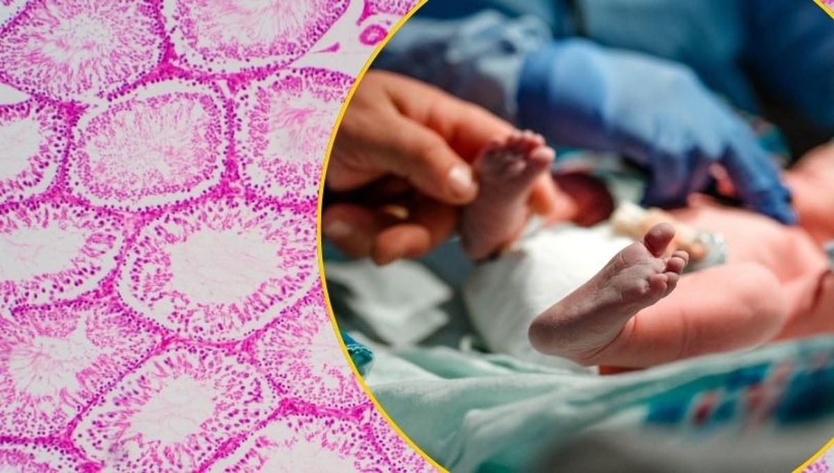 Genetyczna pułapka w banku spermy. Blisko 200 dzieci w Europie zagrożone rakiem