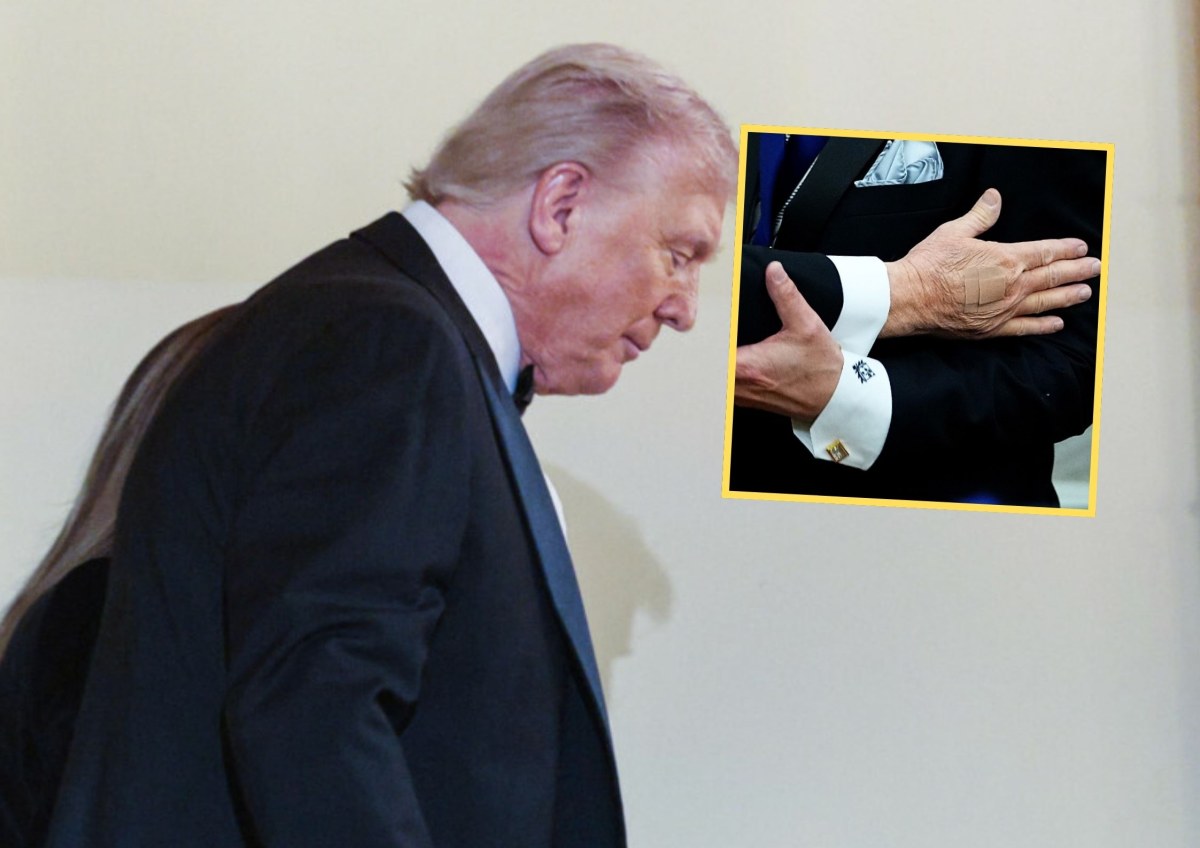 Plastry na dłoni Donalda Trumpa wywołały lawinę pytań. Rzeczniczka tłumaczy