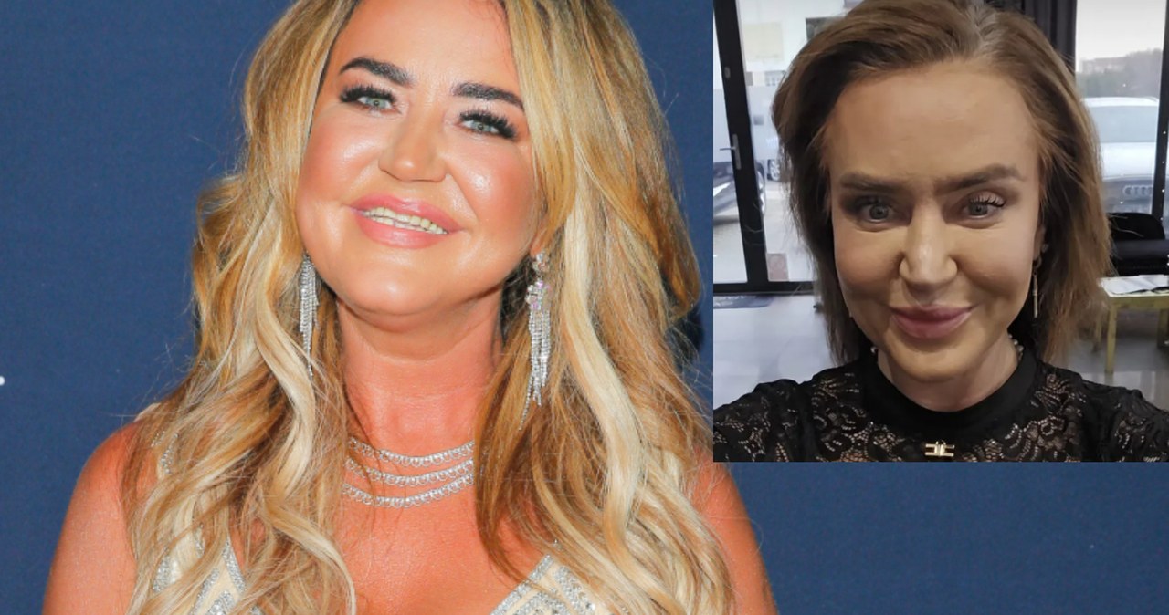 Agnieszka Kotońska zdjęła doczepy. Widok wprawił ludzi w osłupienie