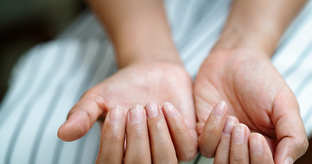 Nie jesteś skazana na żółte paznokcie. Rób tak, a hybryda ci nie zaszkodzi