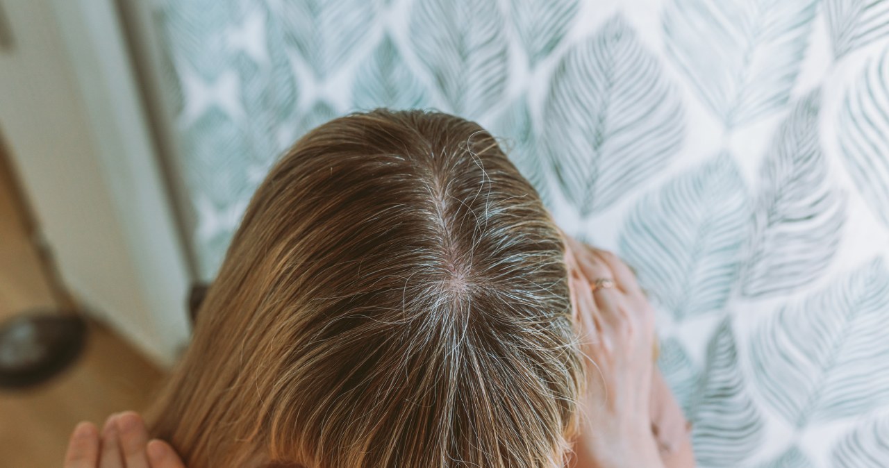 One też się starzeją. Żeby zawsze były piękne, trzeba zadbać o jedną rzecz