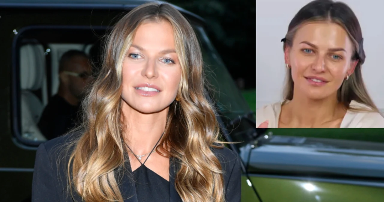 Anna Lewandowska daje odpór plotkom. „Nie mam ust zrobionych!”