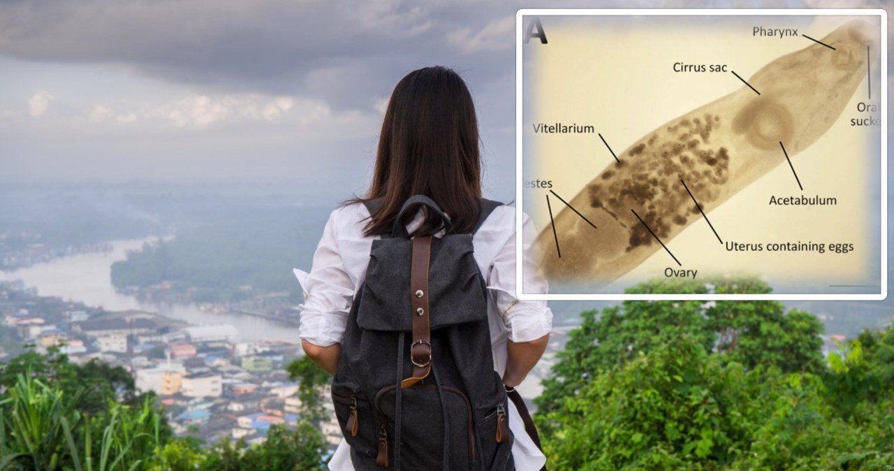 Koszmarna pamiątka z urlopu. Wróciła z robakiem w oku