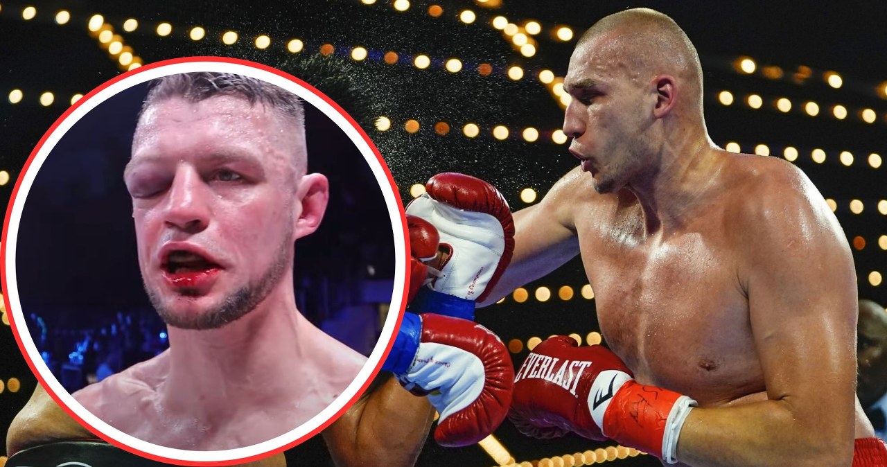 wiadomości,aktualności,Interia Godziny do walki Knyby, a tu komunikat. Sędzia poddał Polaka, to była wojna