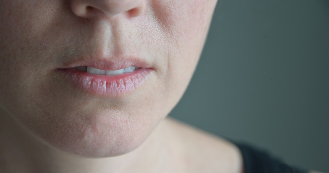 Ciągła suchość w ustach? To objaw poważnej choroby ignorowanej przez lata