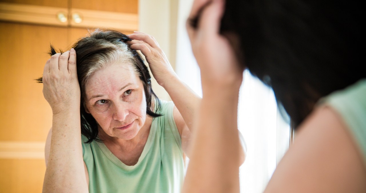 Zaczęło się od kilku srebrnych nitek. Tak dieta może wpływać na siwienie