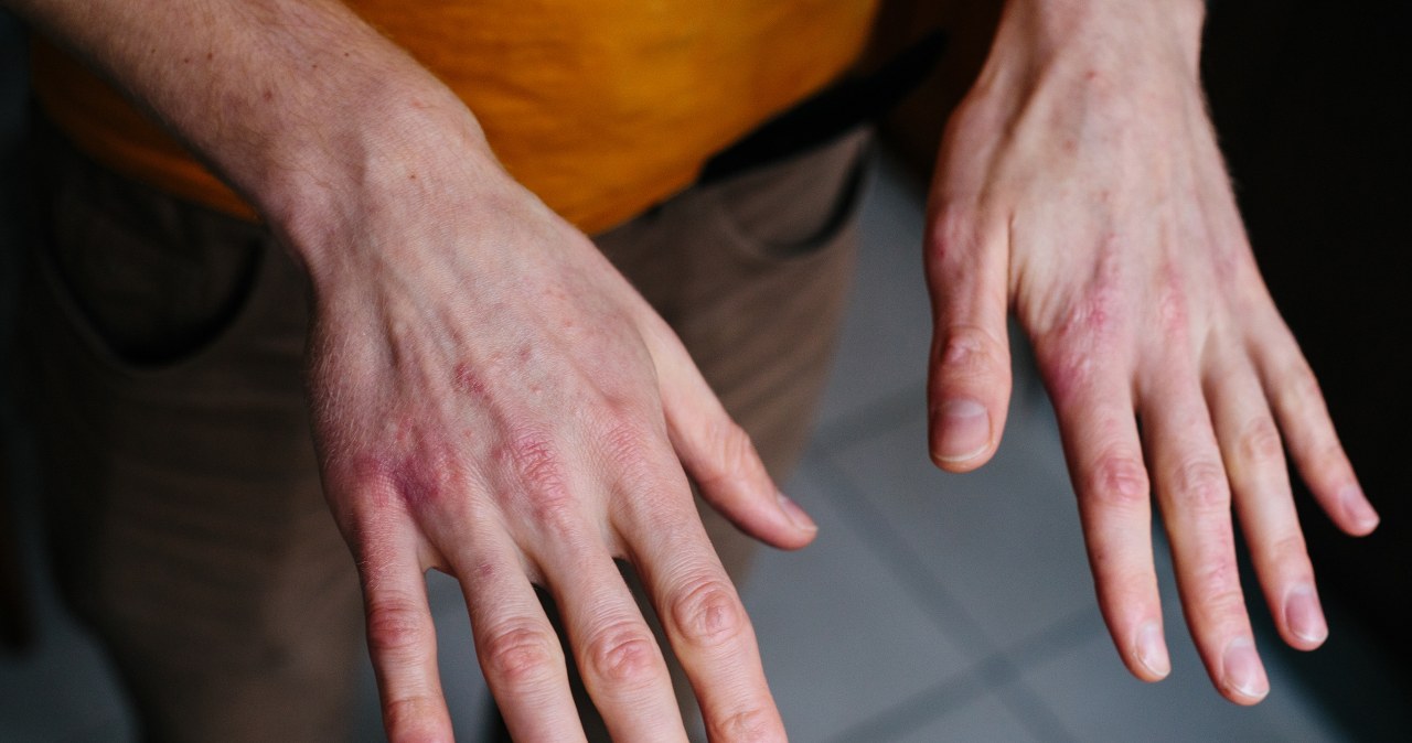 Kremy, które są moimi bohaterami zimą. Natychmiast ratują suchą skórę