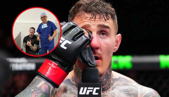 Brutalny faul, a teraz operacja. Są nowe wieści o "polskim" mistrzu UFC 