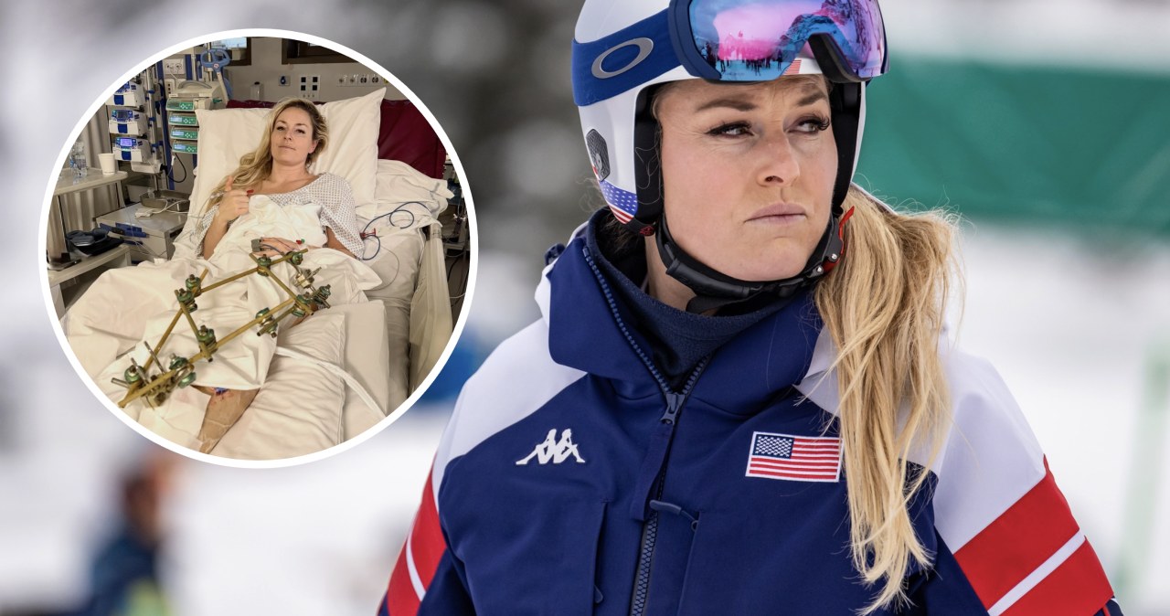 Lindsey Vonn nadała komunikat prosto ze szpitala. Przeszła kolejną operację
