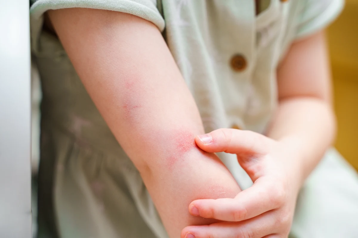 Dramat dzieci w rodzinie zastępczej w Zgierzu koło Łodzi. Jak dowiedział się reporter RMF FM Krzysztof Zasada, policjanci i pracownicy pomocy społecznej stwierdzili poważne obrażenia u chłopca będącego pod opieką małżeństwa, które opiekuje się dodatkowo sześciorgiem dzieci w różnym wieku. 