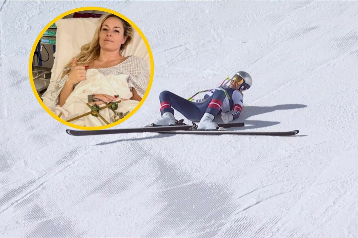 Lindsey Vonn pokazała zdjęcia ze szpitala. "Sukces ma już inne znaczenie"