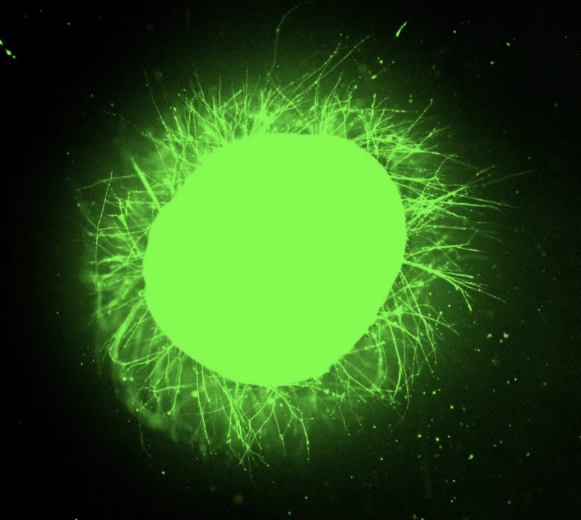 "Tańczące cząsteczki" odbudowują rdzeń kręgowy. Przełom w laboratorium