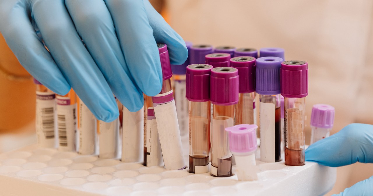 Zrobiony przed badaniem może wpłynąć na wyniki. Wrażliwy zwłaszcza cukier i hormony