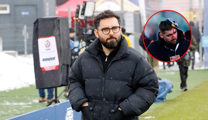 Czerwona kartka dla Feio, a to nie koniec. Polała się krew, policja w akcji