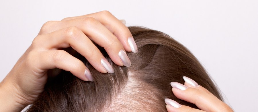 Środowisko, dieta, brak snu, stres, stan zdrowia – to wszystko wpływa na kondycję skóry głowy. Czasami szampon i odżywka to za mało – potrzebna jest diagnoza problemu, takiego jak: łojotok czy łysienie, ale i ogólnego stanu zdrowia. W cyklu Twoje Zdrowie w Faktach RMF FM zachęcamy do tego, żeby zadać sobie pytanie: Czy odpowiednio i wystarczająco dbam o włosy?