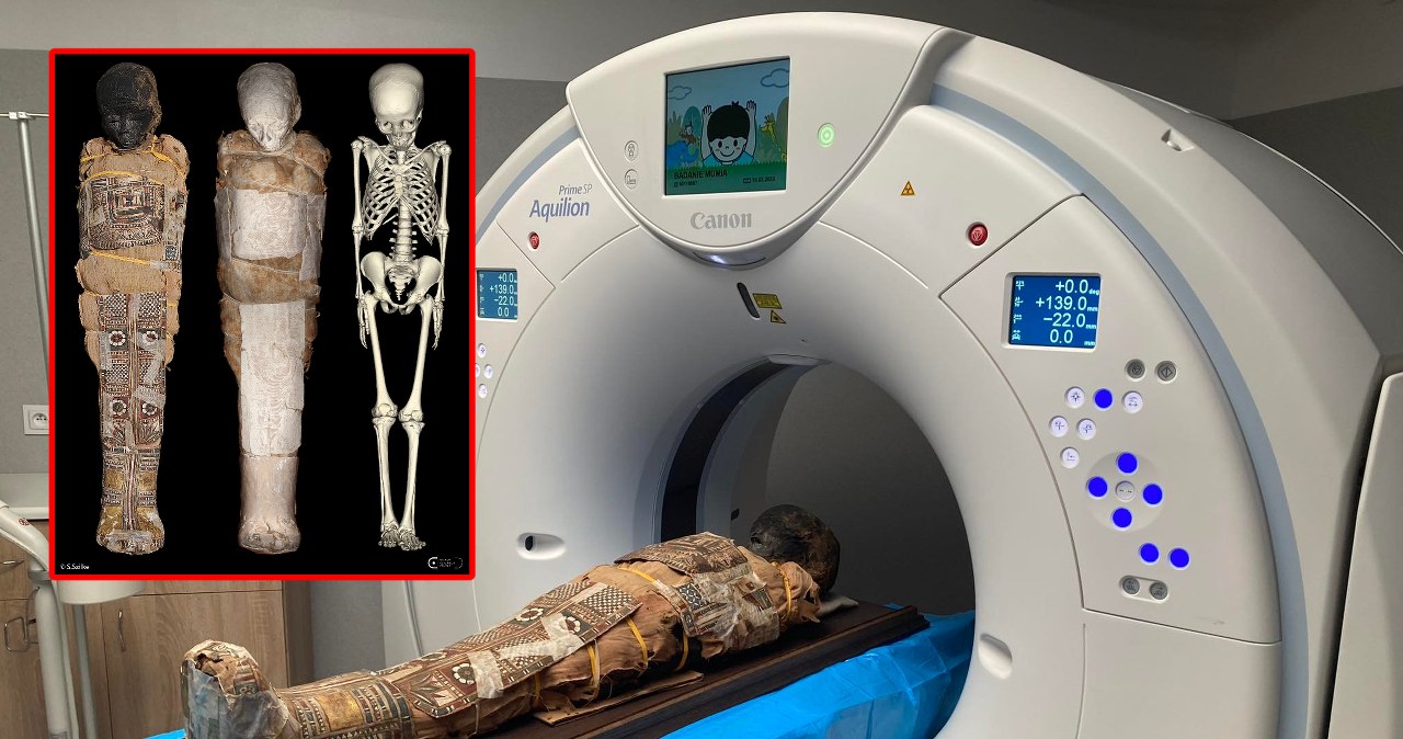 Zagadka tajemniczej mumii z Wrocławia rozwiązana. To ośmioletni chłopiec