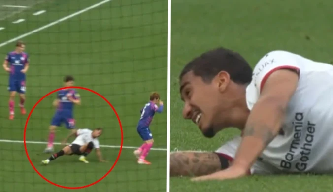 Koszmarna kontuzja w Bundeslidze. Boli od samego patrzenia. Dramat 22-latka