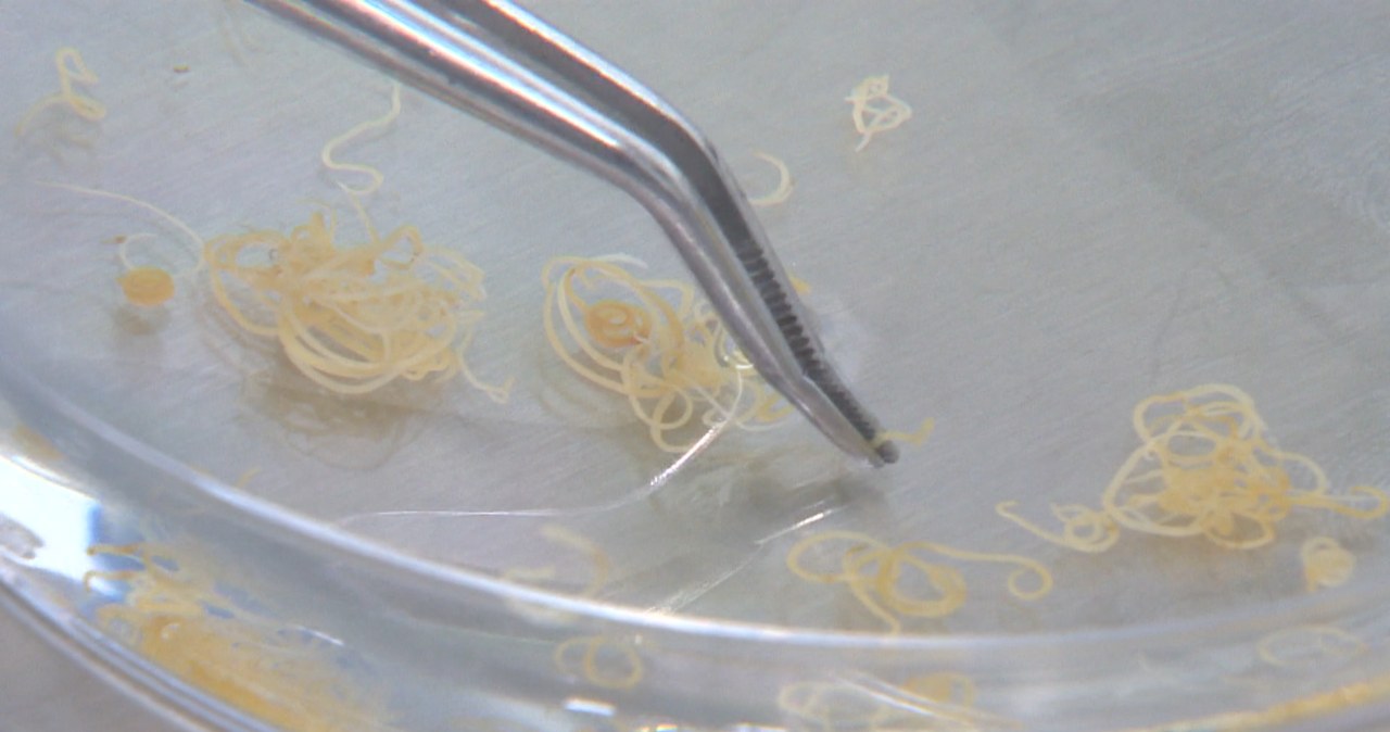 Zaskakujący pomysł Polaków. Pasożyt z Bałtyku ma pomóc ludziom Zaskakujący pomysł Polaków. Pasożyt z Bałtyku ma pomóc ludziom