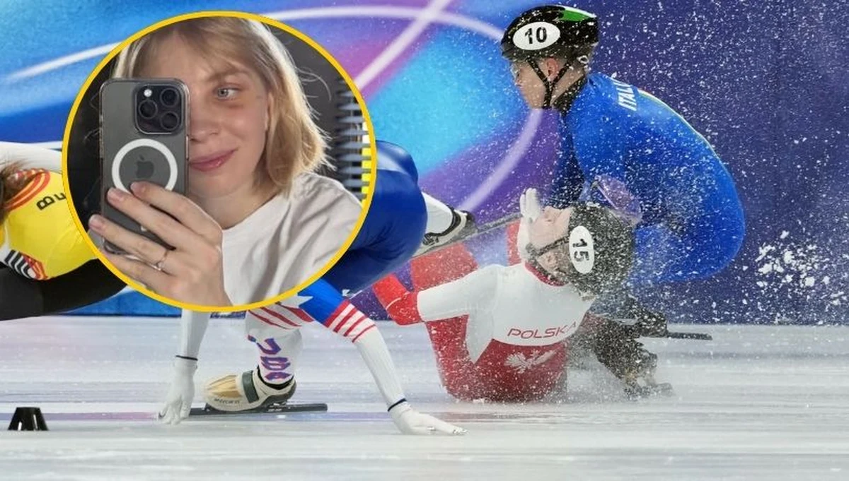 Reprezentantka Polski w short tracku Kamila Sellier, która podczas igrzysk olimpijskich w Mediolanie doznała urazu twarzy, poinformowała w środę, że przeszła operację rekonstrukcji oczodołu. Sportsmenka dodała, wszystko zmierza w dobrym kierunku i opublikowała na Instagramie swą aktualną fotografię.