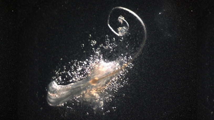 Naukowcy wyhodowali mieszki włosowe. Przełom w walce z łysieniem