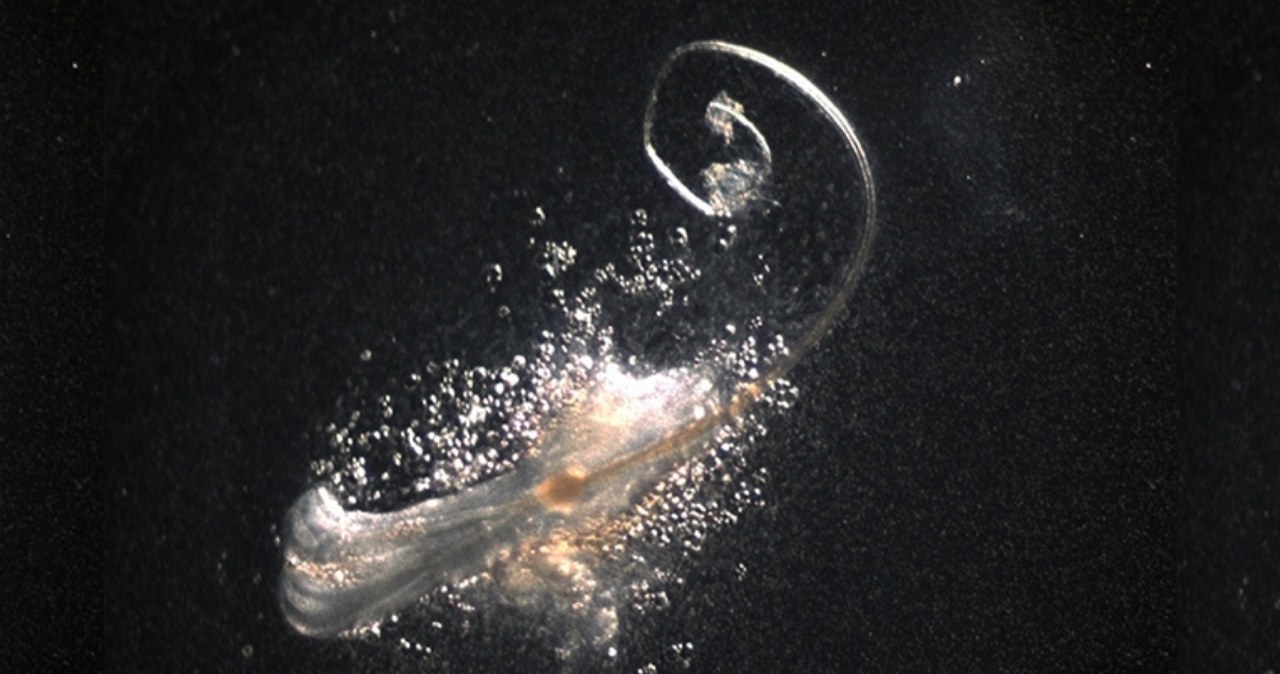 Naukowcy wyhodowali mieszki włosowe. Przełom w walce z łysieniem