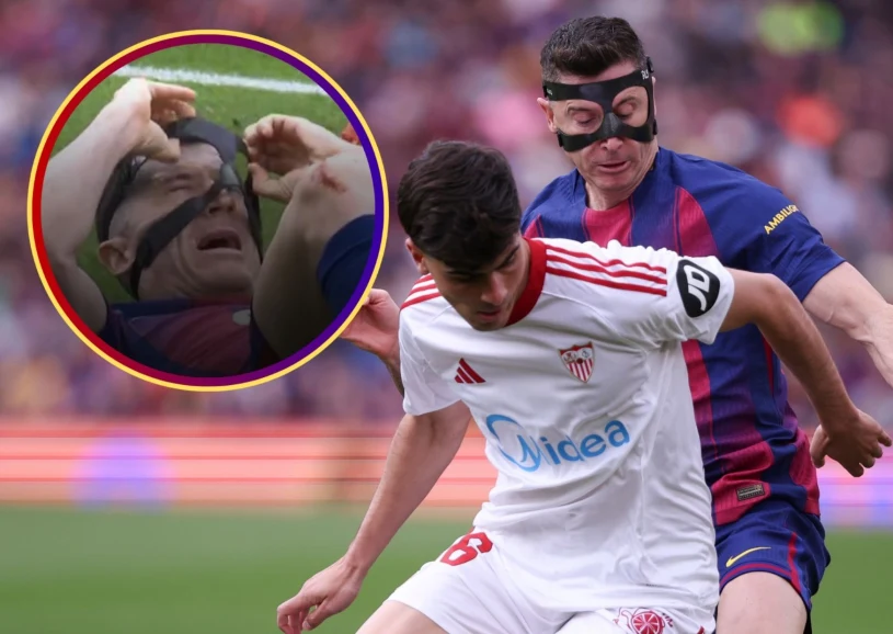 Tego "Lewy" obawiał się najbardziej. Jest gorzej niż myślano. Fatalny obrazek