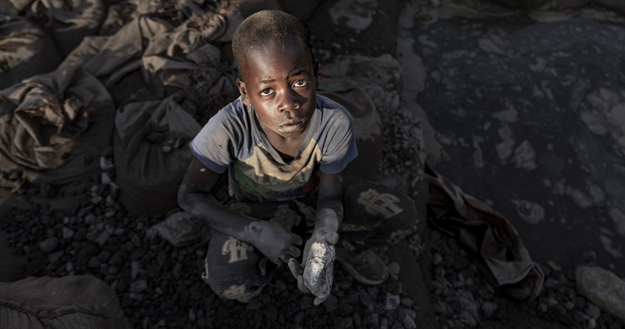 Mroczna strona zielonej energii. Dzieci wykazują potworne objawy Mroczna strona zielonej energii. Dzieci wykazują potworne objawy