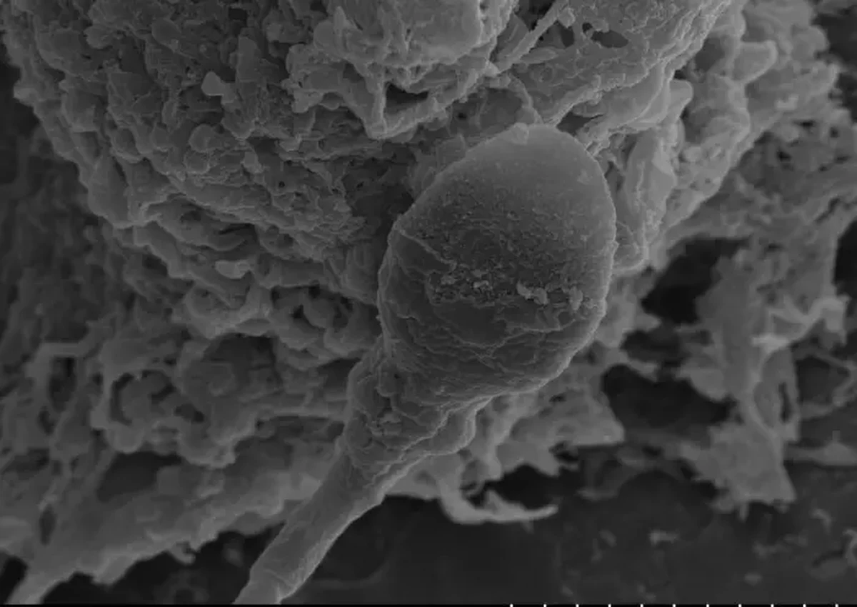 Rozmnażanie się ludzi i zwierząt poza Ziemią może być trudniejsze, niż myśleliśmy. Najnowsze badania naukowców z Uniwersytetu w Adelajdzie wskazują, że brak grawitacji może znacząco utrudniać proces zapłodnienia, a nawet rozwój zarodka. Autorzy piszą w najnowszym numerze czasopisma "Communications Biology", że w warunkach symulujących mikrograwitację plemniki tracą orientację.